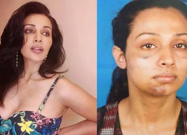 Flora Saini private parts are attacked on 14 months